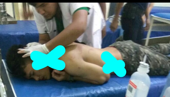 Berniat Bela Sang Kekasih, Pemuda di Inhil Terkena Sabetan Benda Tajam