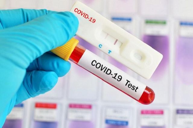 Update Covid-19 Pada 6 Juni 2020 di Aceh, Sumut, Sumbar, Riau, Kepri, Jambi, dan Bengkulu