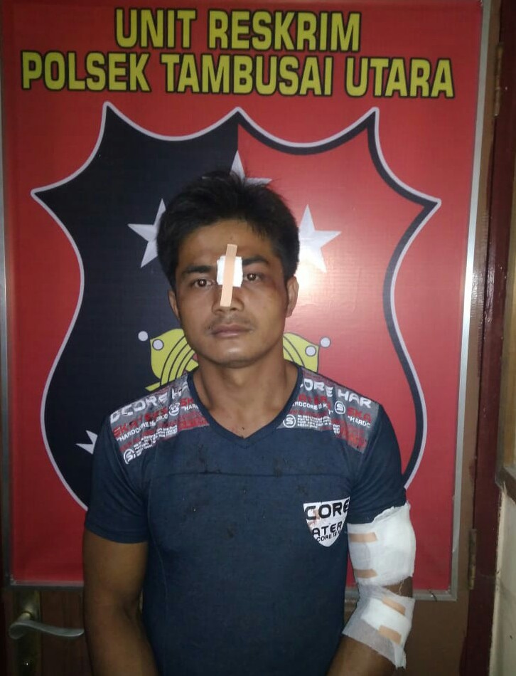 Diawali cekcok Mulut, Karyawan Torganda Tusuk Temannya Hingga Tewas