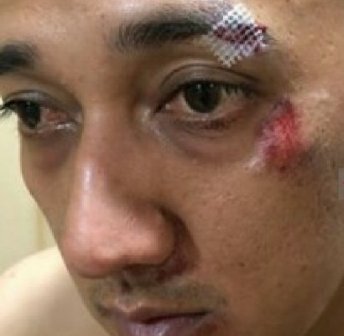 Bandar Narkoba Pengeroyok Kapolsek Patumbak di Tembak