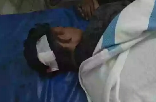 Nonton Orgen Tunggal, Dua Pemuda di Inhil Terkena Senjata Tajam