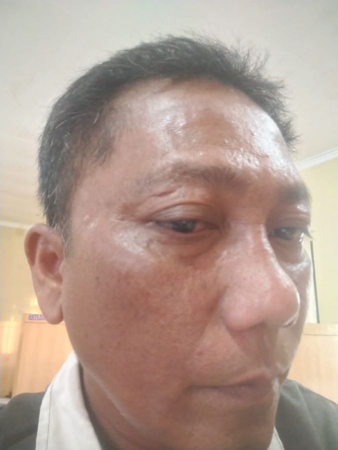Jurnalis Dipukul Saat Liputan! PJS Sumut Desak Polisi Tangkap Bos Galian C
