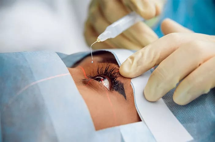 Mengenal Prosedur LASIK Mata Sebagai Solusi Modern Koreksi Penglihatan