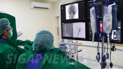 RS Adam Malik Dampingi Operasi Coiling Aneurisma Perdana di Deli Serdang